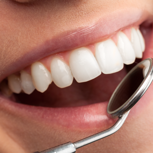 Gilmara Dentista - Dente