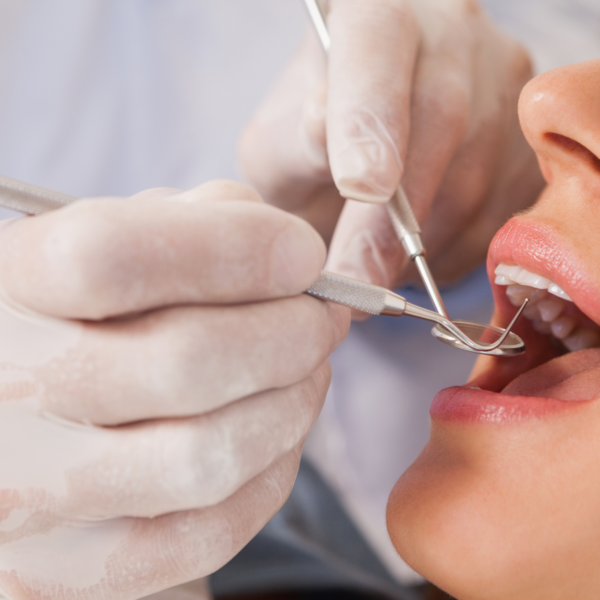 Gilmara Dentista - Dente 01